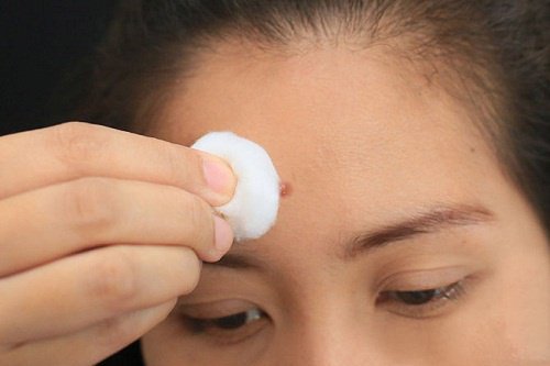 6 Internal Problems Pimples and Spots May be Revealing