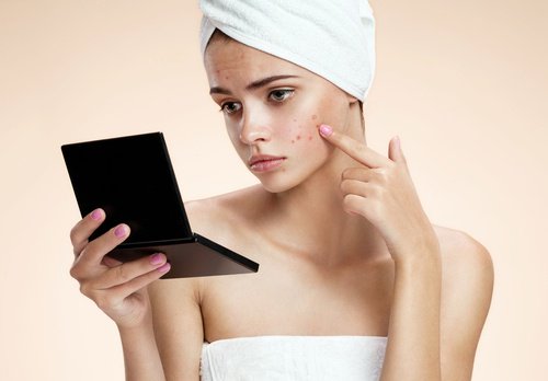 Girl looking at spots in the mirror