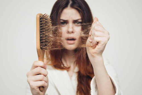 A woman who suffers from hair loss.