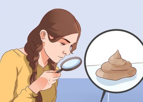 What the Shape and Color of Your Stool Say About Your Health
