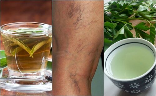 Five Diuretic Teas to Drink if You Suffer from Varicose Veins