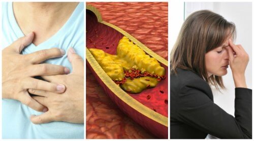 Ten Symptoms of High Cholesterol You Shouldn’t Ignore