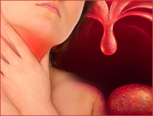 Treat pharyngitis to deal with its bad effects