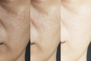 Eight Homemade Remedies to Shrink Enlarged Pores