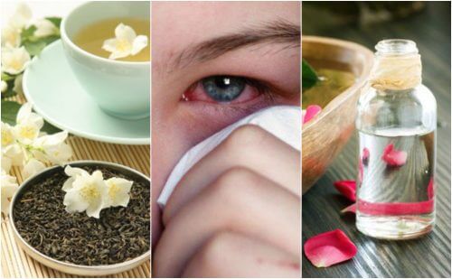 Treat Eye Infections Naturally with these 5 Remedies