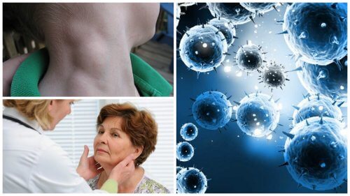 Lymphoma is Treatable if Detected Early