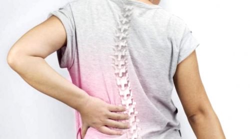 Scoliosis: A Very Common Problem for Women