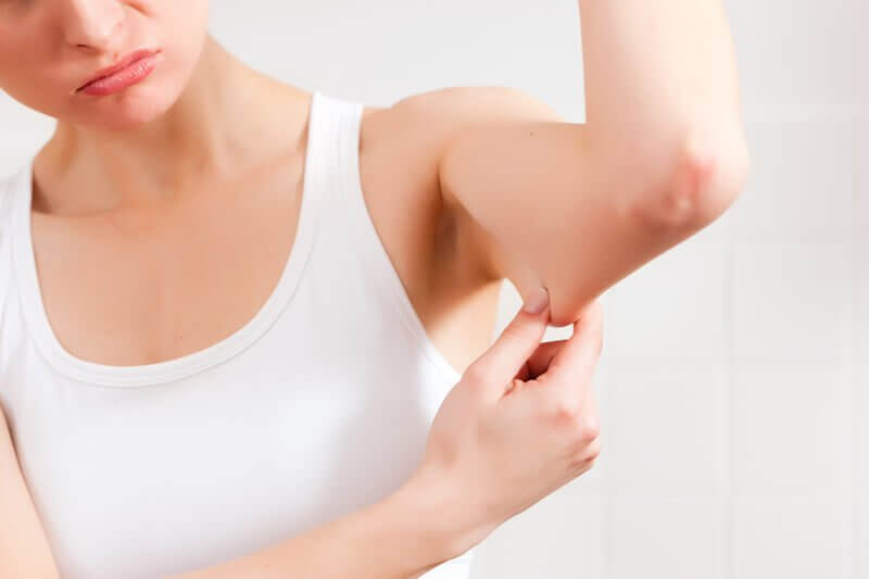 Saggy skin under arms
