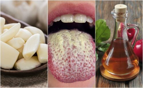 Control Candida Growth with these 6 Natural Remedies