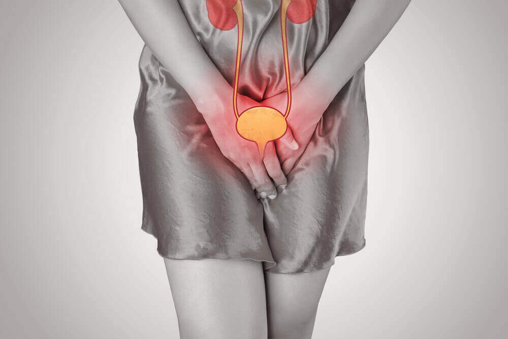 A woman with cystitis.