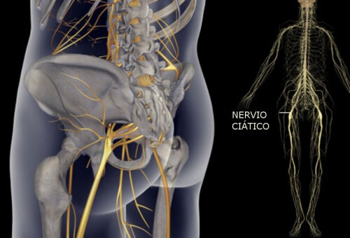 Simple Exercises to Heal Sciatic Nerve Pain Simple Exercises to Heal Sciatic Nerve Pain