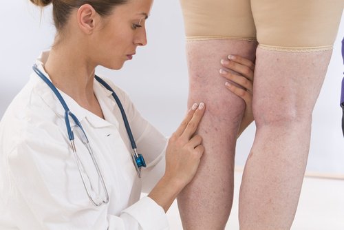 Doctor looking at inflammation of a patient