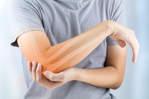 5 Wonderful Foods for Preventing Osteoarthritis 5 Wonderful Foods for Preventing Osteoarthritis