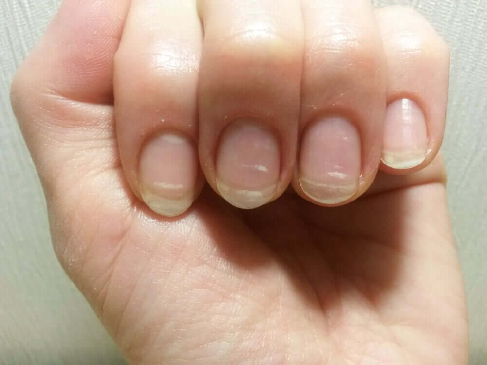 What the Lunula of Your Nails Says about Your Health Step To Health