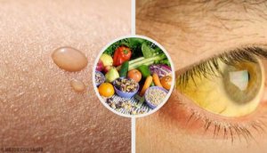 10 Common Vitamin Deficiencies and What to Do About Them