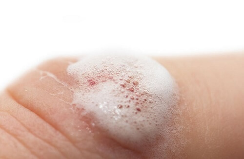 clean wound