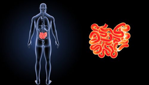 What is an Inguinal Hernia?