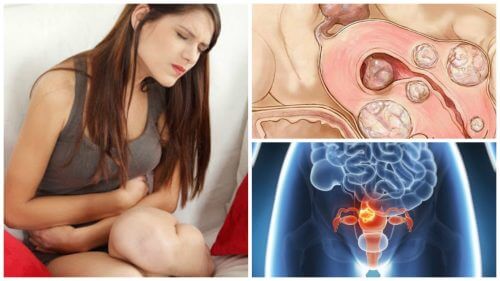 5 Facts About Uterine Fibroids That Every Woman Should Know