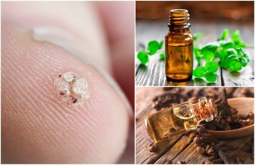 Seven Essential Oils to Try if You Have Warts