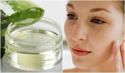 Reduce Stretch marks, Scars and Blemishes with this Home Remedy