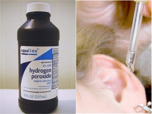 Hydrogen peroxide to fight ear moisture