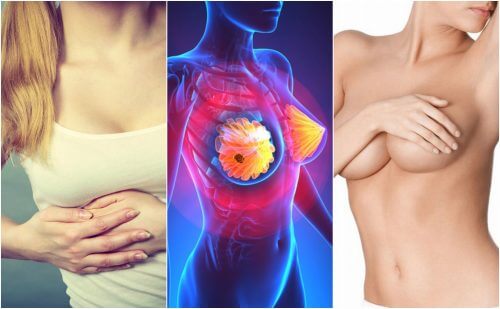 9 Symptoms of Breast Cancer All Women Should Know