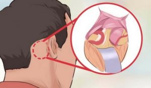 5 Facts About Trigeminal Neuralgia, the Worst Pain in the World