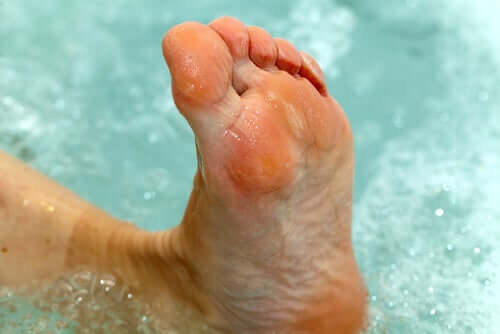 A foot in water with athletes foot.