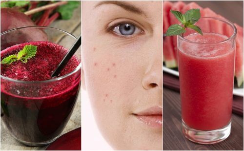 Fight Acne by Adding these 5 Detox Smoothies to Your Diet
