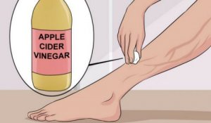 Treat Varicose Veins With Aloe Vera, Carrot and Apple Cider Vinegar
