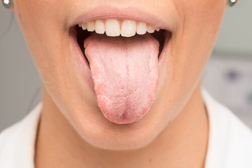 remove tongue whiteness