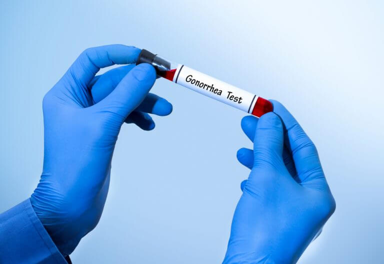 Gonorrhea test
