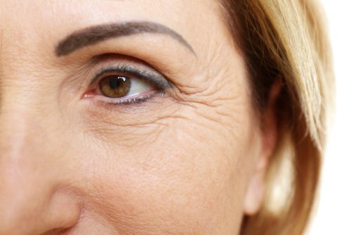 Did You Know that Crow's Feet Mean Something and You Can Prevent Them?