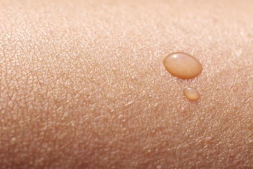 Dry skin