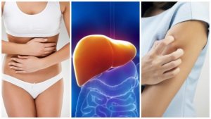 Eight Symptoms of a Liver Overloaded with Toxins