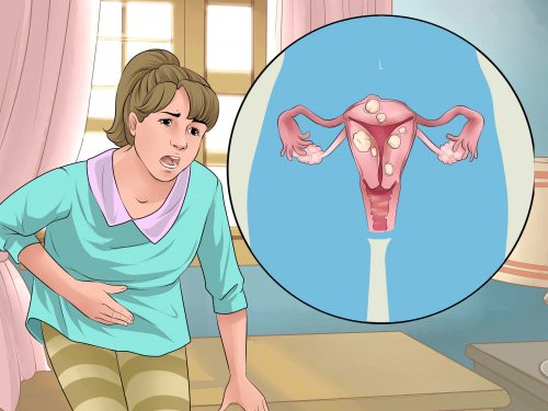 Natural Remedies for Menstrual Cramps and Other Menstrual Problems