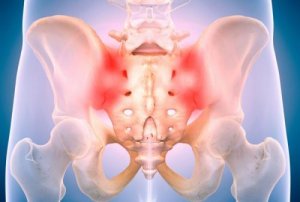 Sacroiliac Joint Pain - When Sitting is Unbearable