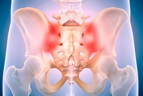 Sacroiliac Joint Pain - When Sitting is Unbearable