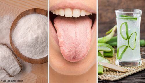 8 Natural Remedies to Get Rid of White Tongue