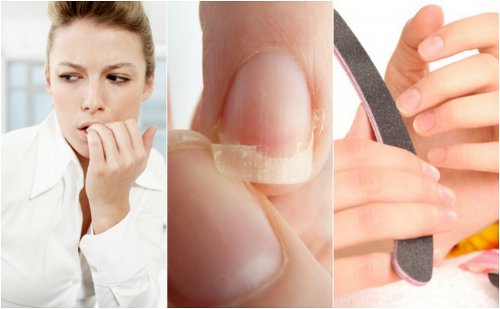 8 Reasons Your Nails are Brittle