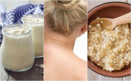 Natural Remedies to Reduce Dark Spots on Your Neck