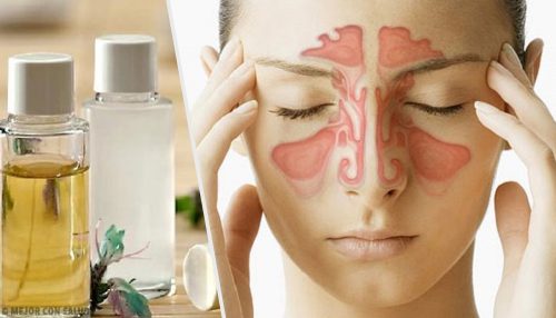 Three Natural Remedies that May Help Clear Your Sinuses