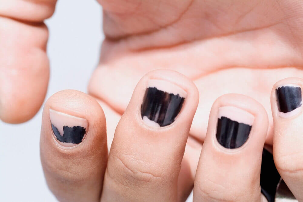 不適當去除指甲油