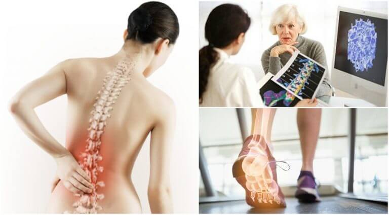 Kvinde med rygsmerter
