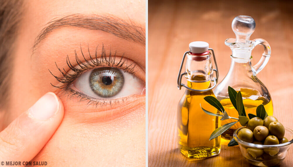 6 Natural Remedies for Eye Inflammation
