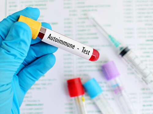 Autoimmune-test