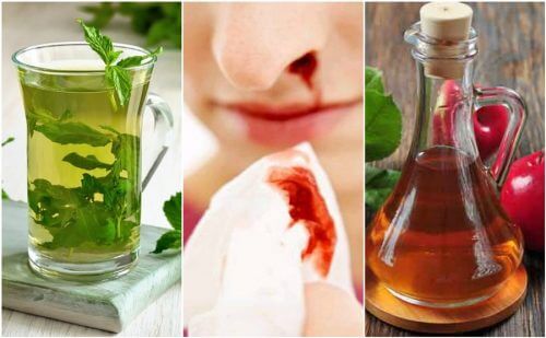 How to Stop Nosebleeds with 5 Natural Remedies How to Stop Nosebleeds with 5 Natural Remedies