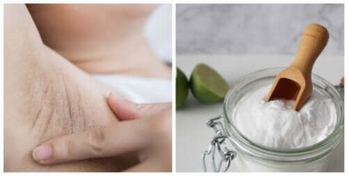 Six Natural Ways to Lighten Underarms