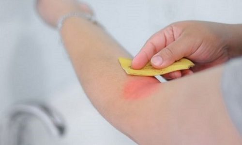 用香蕉皮擦拭手臂