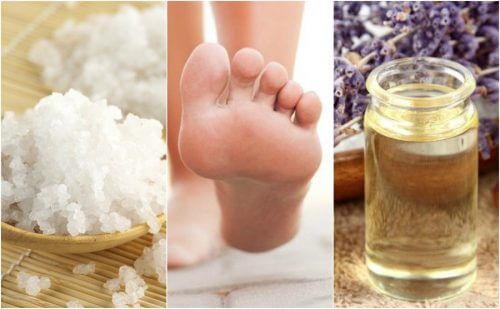 5 Home Remedies for Plantar Fasciitis